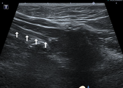case_image